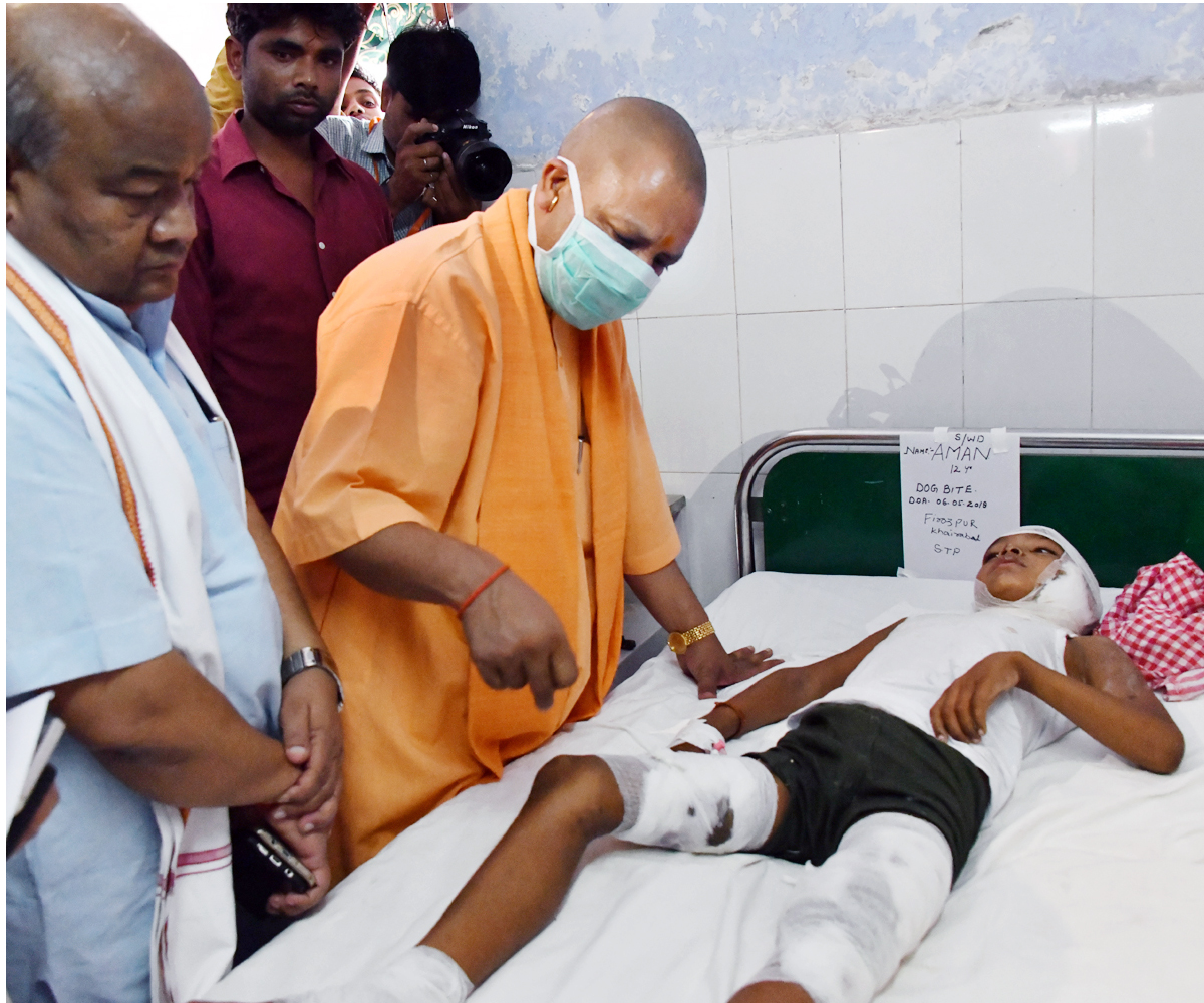 UPCM सीतापुर में आदमखोर कुत्तों के हमलों से घायल बच्चों का हाल-चाल लेते हुए